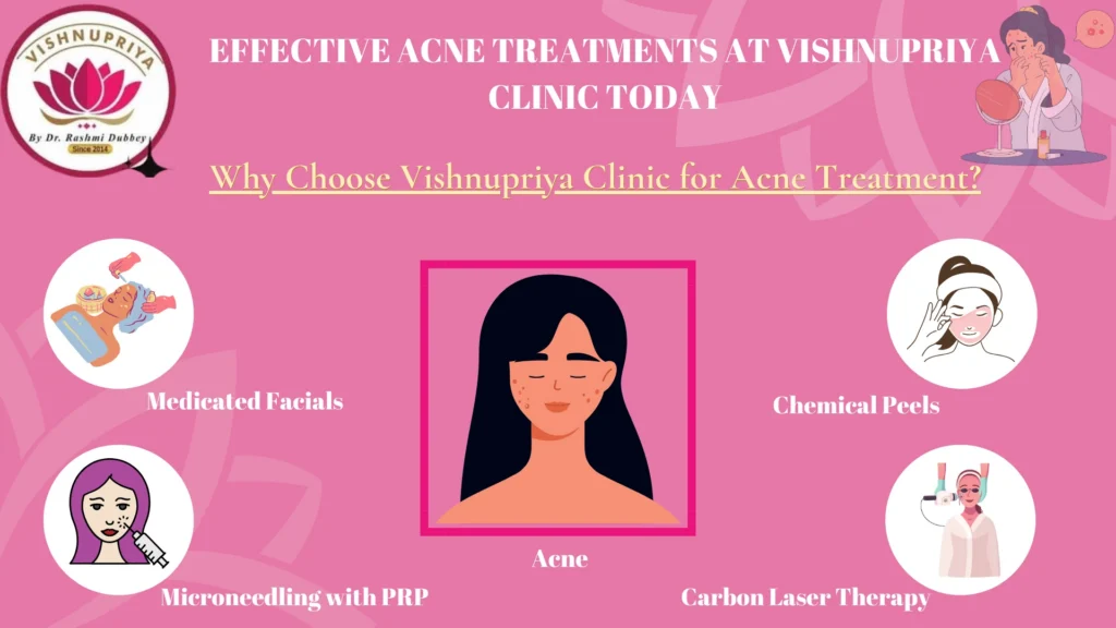 Acne Treatments