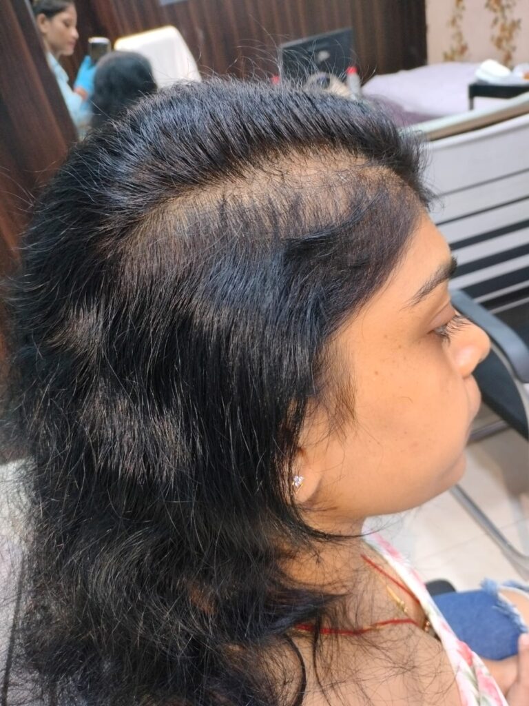  before treatment