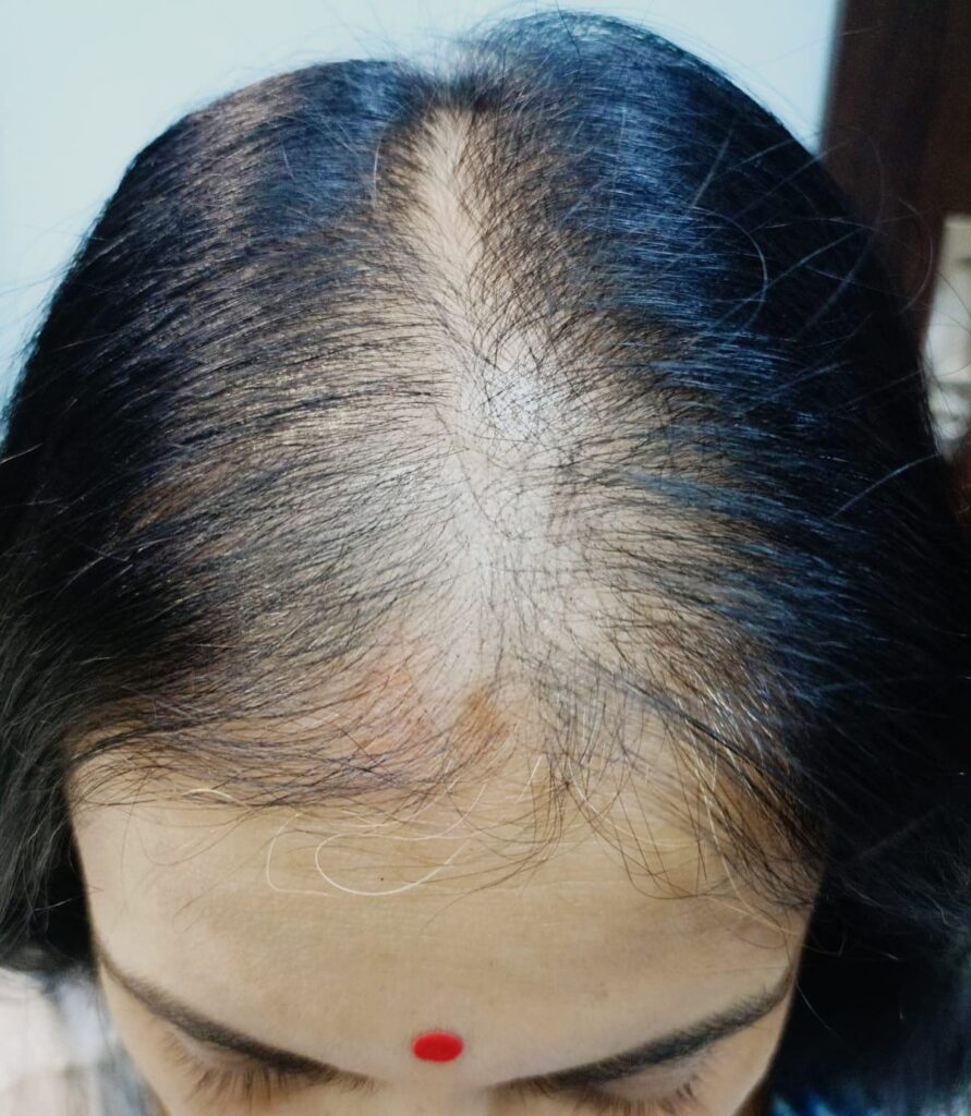  before treatment