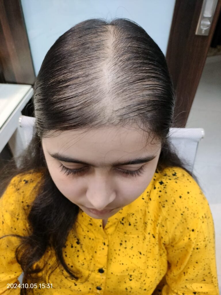  before treatment