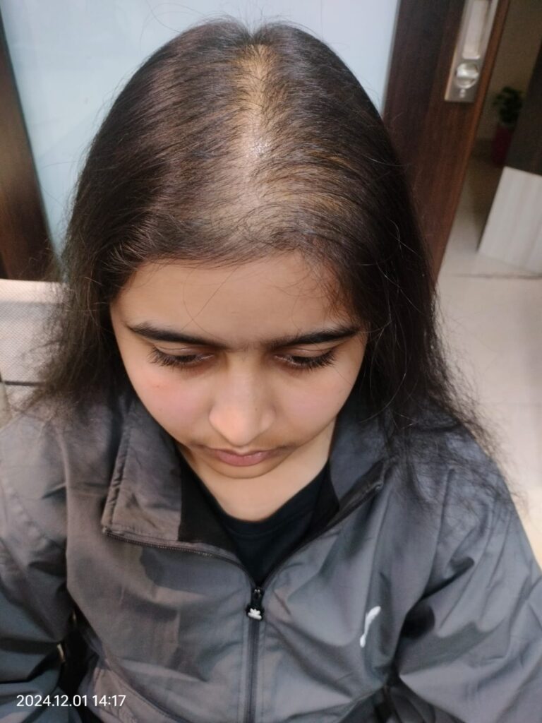  after treatment