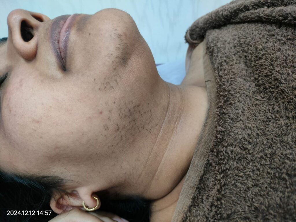 before treatment