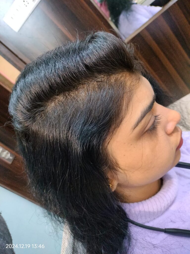  after treatment