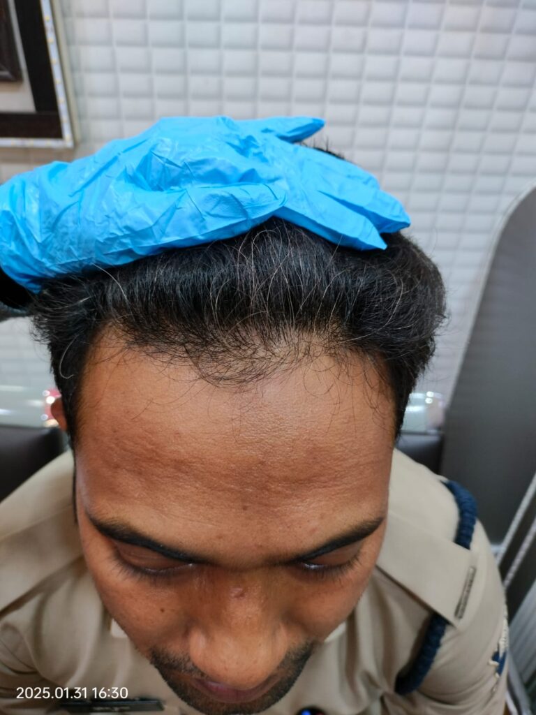 after treatment