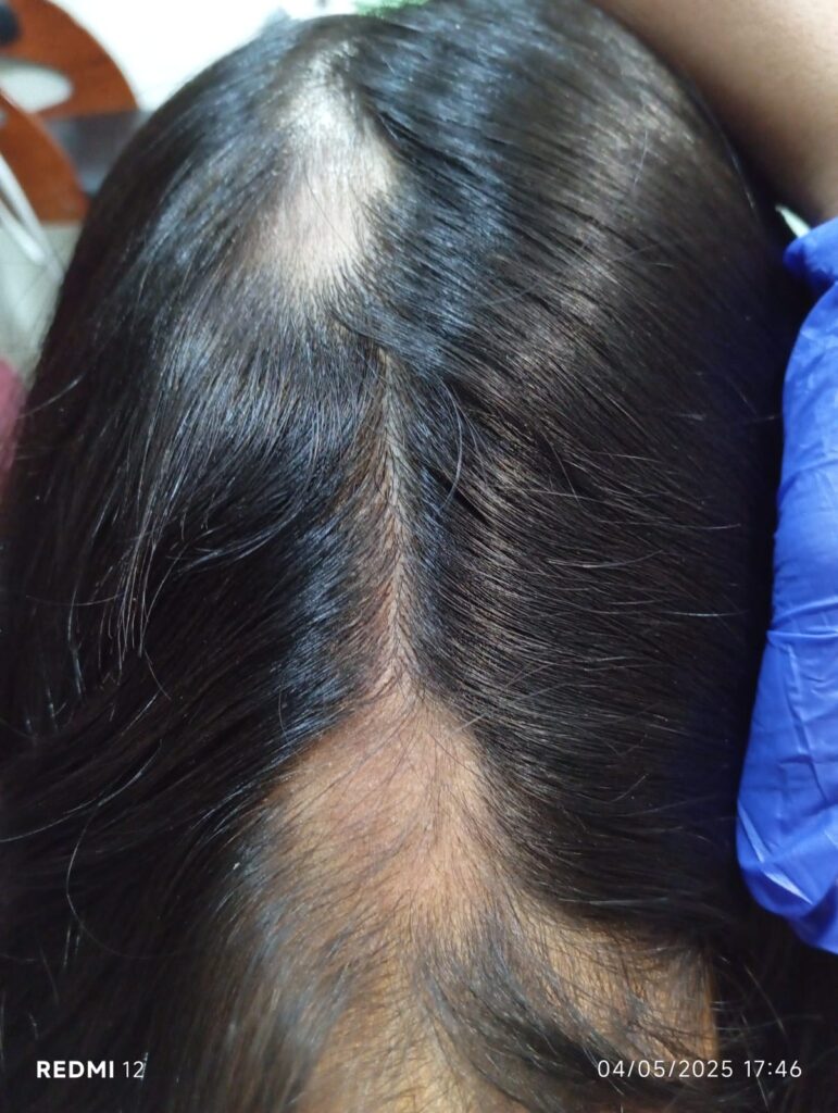  before treatment