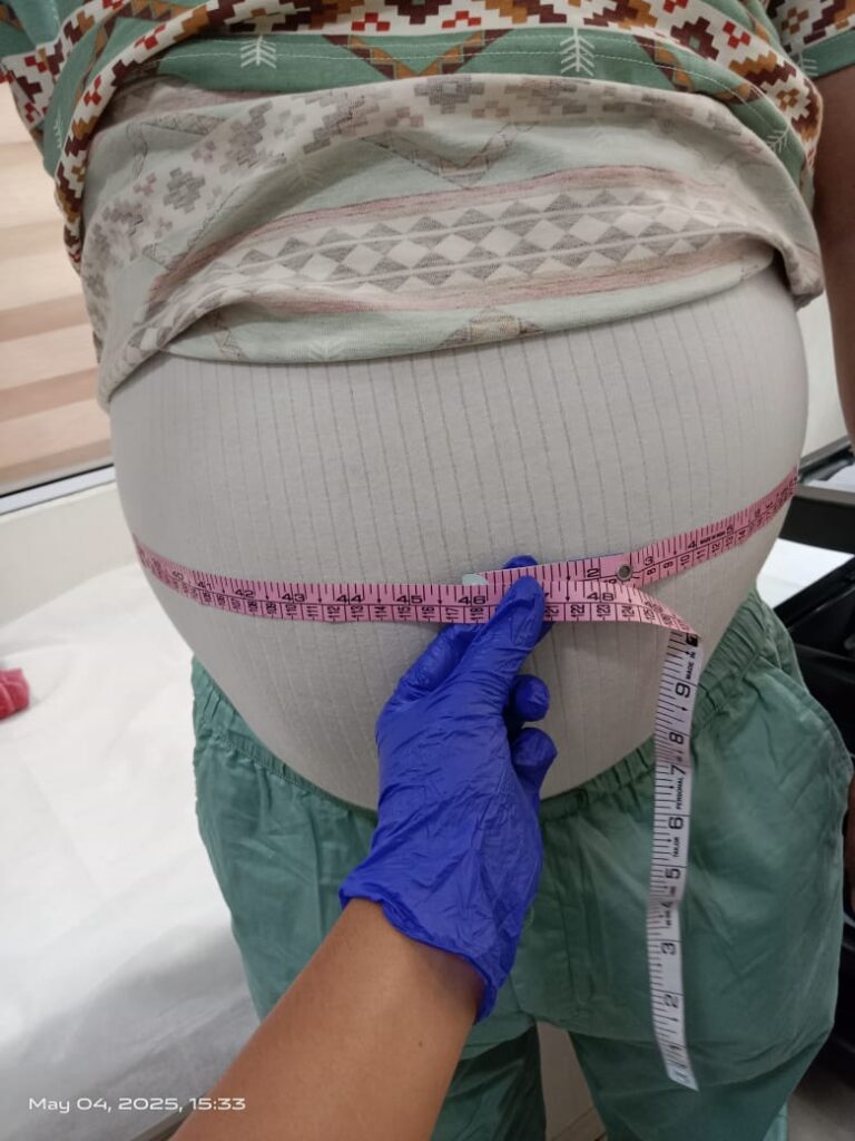  before treatment