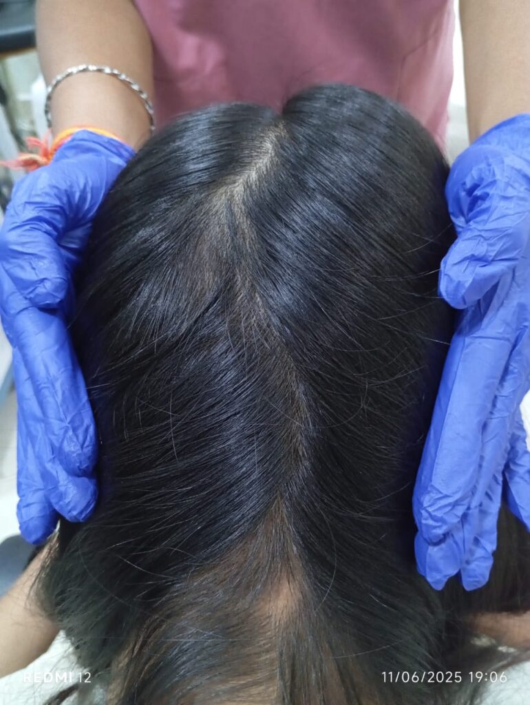  after treatment