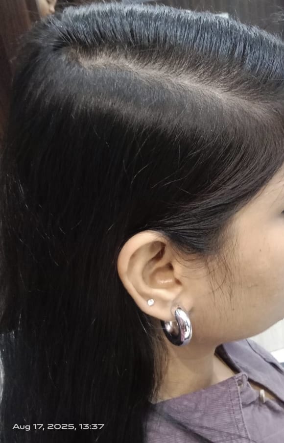  after treatment