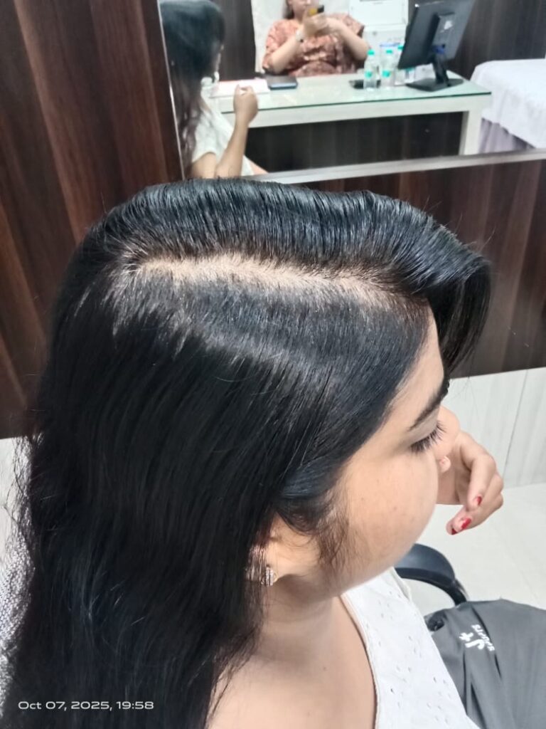  before treatment