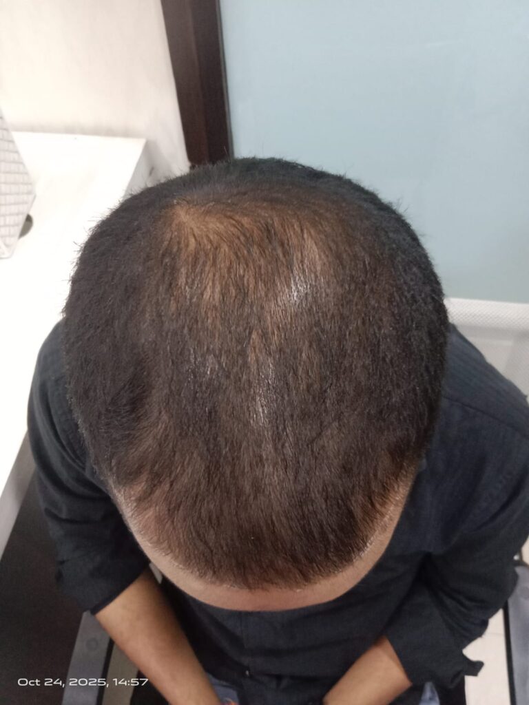 before treatment