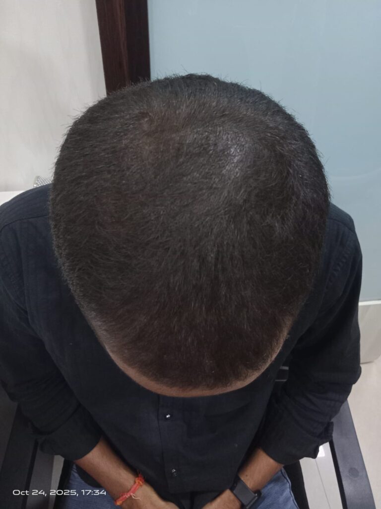  after treatment