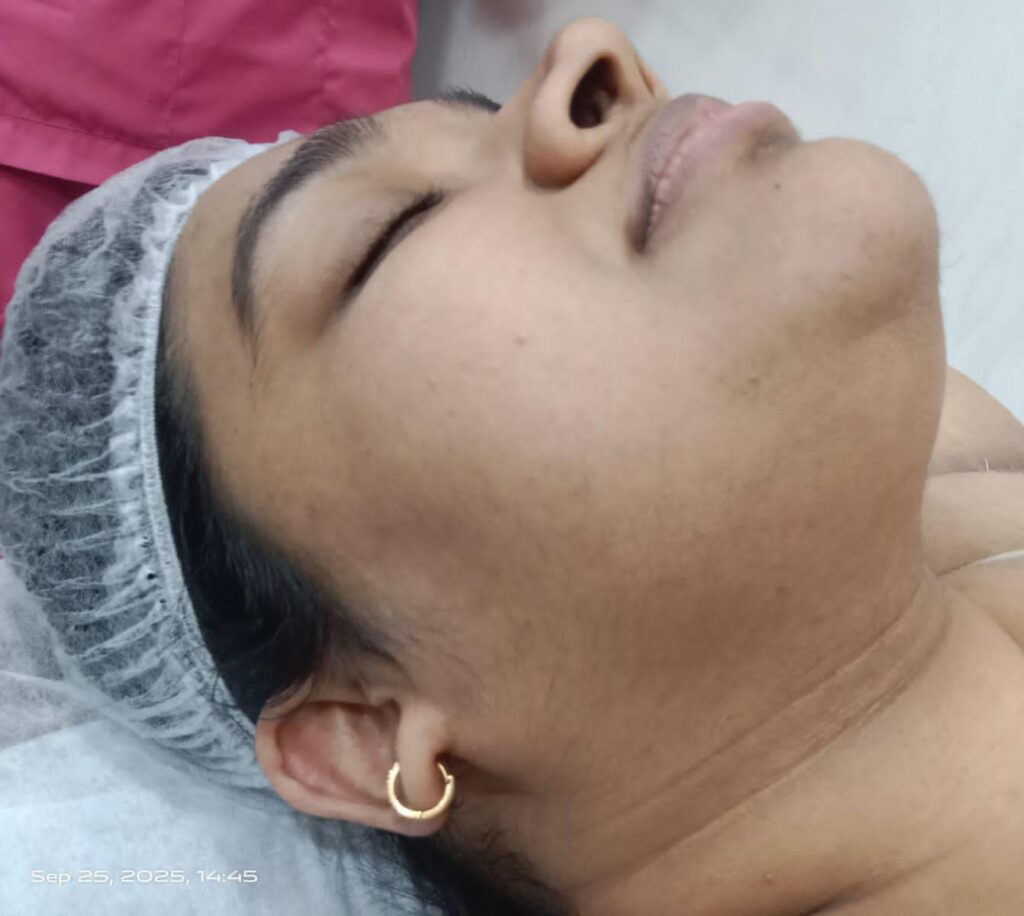  after treatment