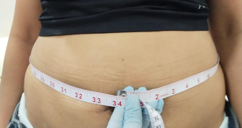  before treatment