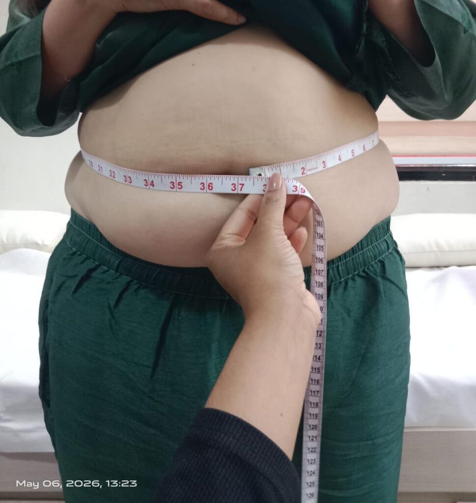  after treatment