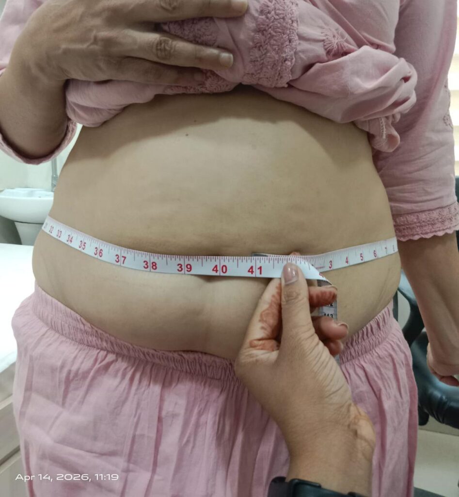  before treatment