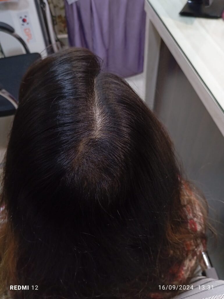 after treatment