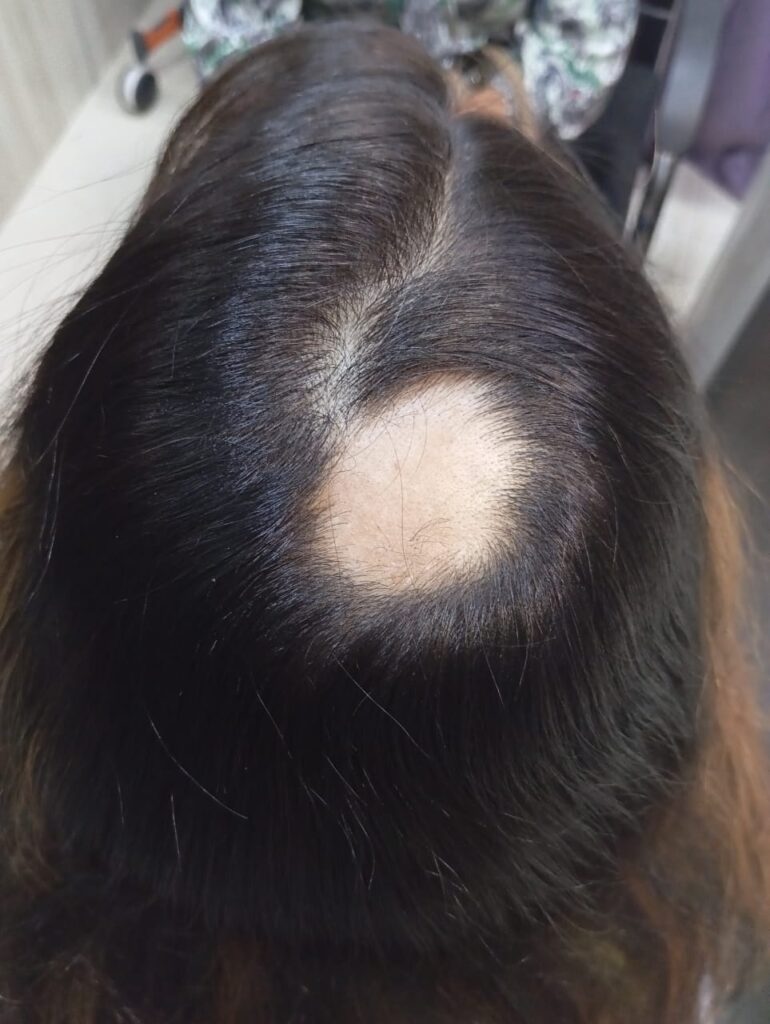  before treatment
